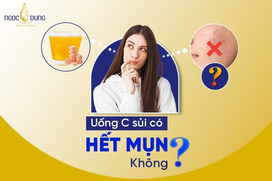 Uống c sủi có hết mụn không? Giải đáp ngay cùng chuyên gia