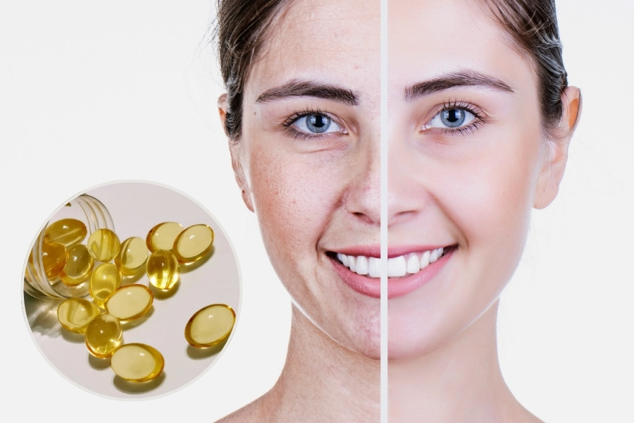 Làm mờ thâm nám là một trong công dụng của vitamin e khi bôi lên mặt nổi bậc