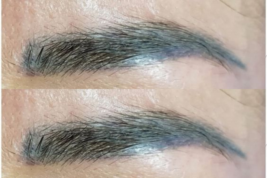 Hình ảnh xăm lông mày hỏng, bị trổ xanh