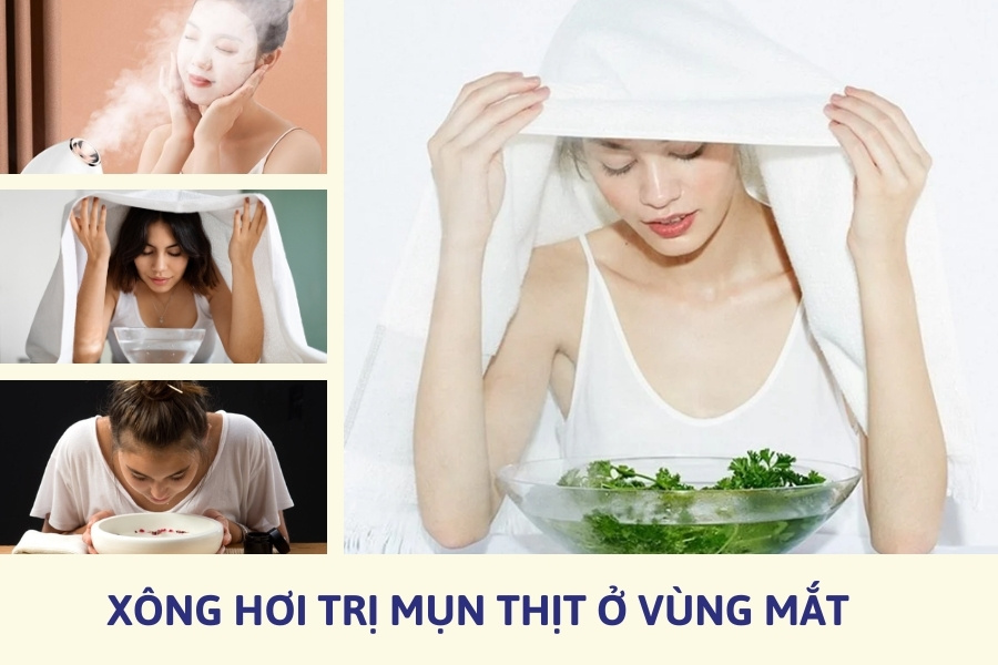 Xông hơi cũng là phương pháp trị mụn thịt ở mắt được nhiều chị em tin chọn Xông hơi cũng là phương pháp trị mụn thịt ở mắt được nhiều chị em tin chọn