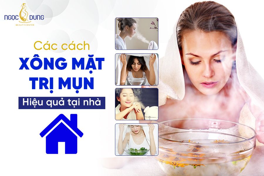 Mặt mụn có nên xông mặt không? Tổng hợp các cách xông mặt trị mụn siêu hiệu quả