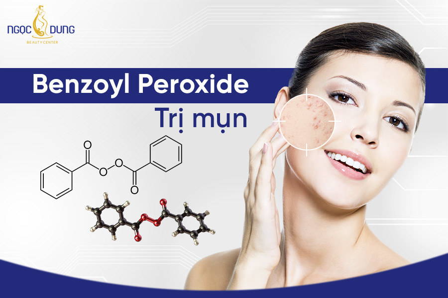 Dùng Benzoyl Peroxide trị mụn nào? Công dụng và cách dùng