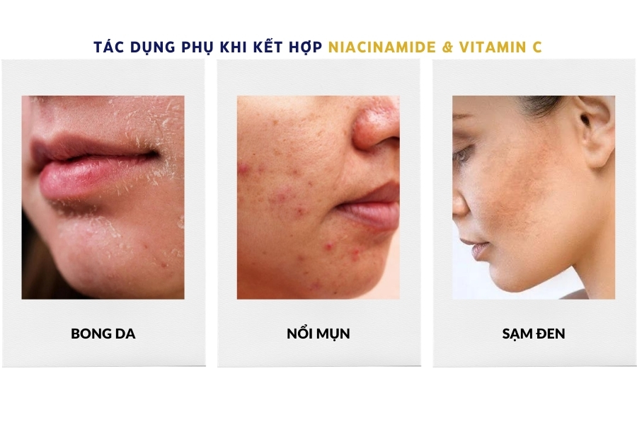Tác dụng phụ tiềm ẩn khi kết hợp Niacinamide và Vitamin C