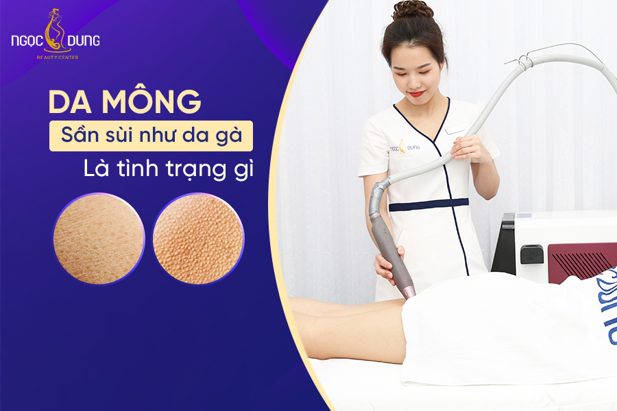 Tìm hiểu ngay nguyên nhân và cách điều trị tình trạng da mông sần sùi như da gà dưới đây! da mông sần sùi như da gà