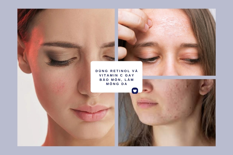 Dùng Retinol và Vitamin C làm mỏng da có đúng không?