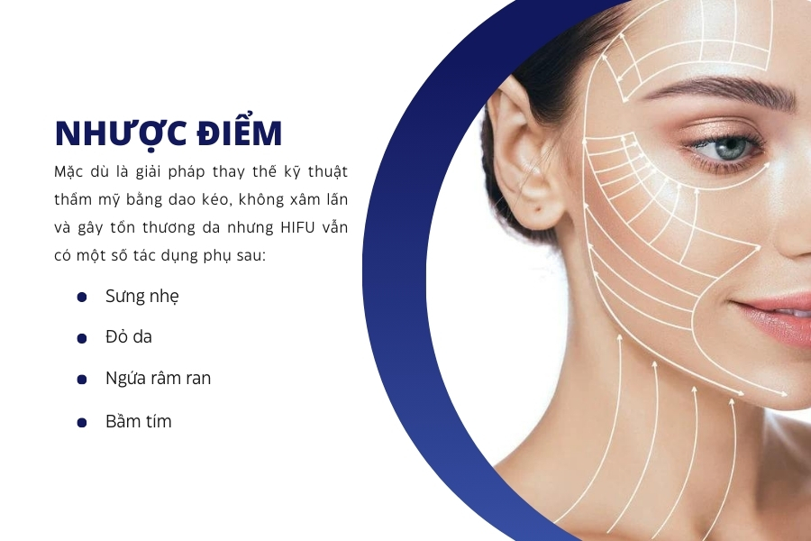 Nhược điểm của công nghệ HIFU là gì?
