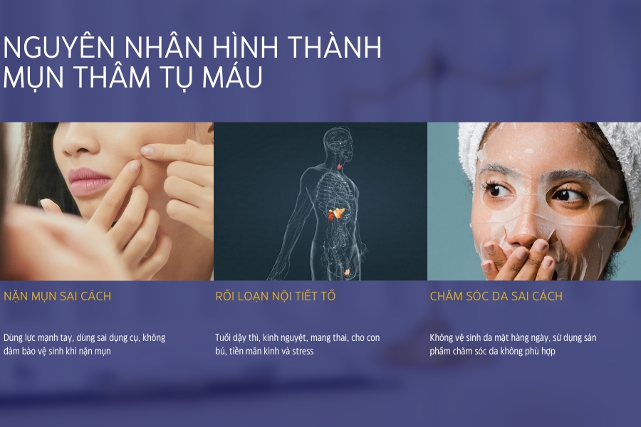 Nguyên nhân dẫn đến tụ máu ở các nốt mụn là gì? Nguyên nhân dẫn đến tụ máu ở các nốt mụn là gì?