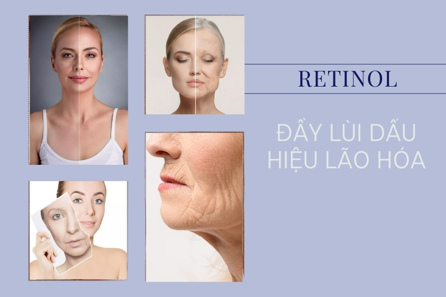 Dùng Retinol đều đặn có thể giảm nếp nhăn và tăng độ đàn hồi cho da