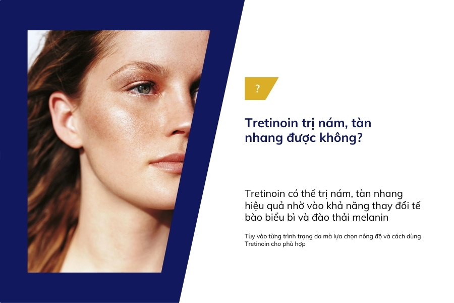 Dùng Tretinoin trị nám, tàn nhang có được không?