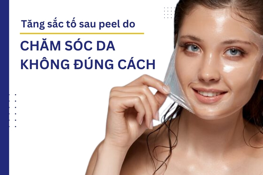 Da bị tăng sắc tố sau peel do không được chăm sóc đúng cách