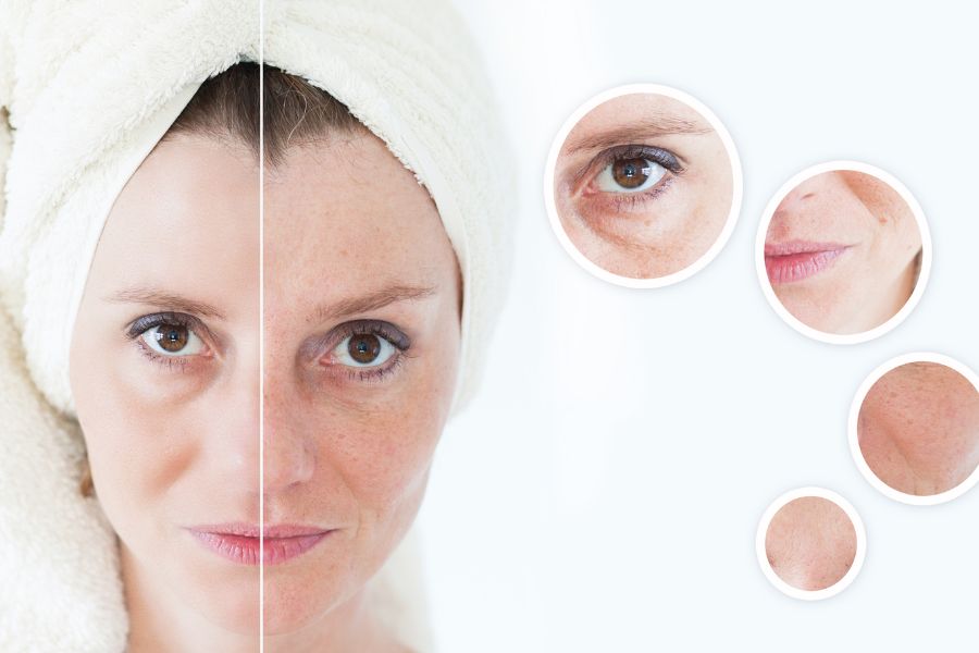 Dầu oliu có khả năng ngăn ngừa lão hóa nhờ chứa chất chống oxy hóa Dầu oliu hỗ trợ ngăn ngừa lão hóa da