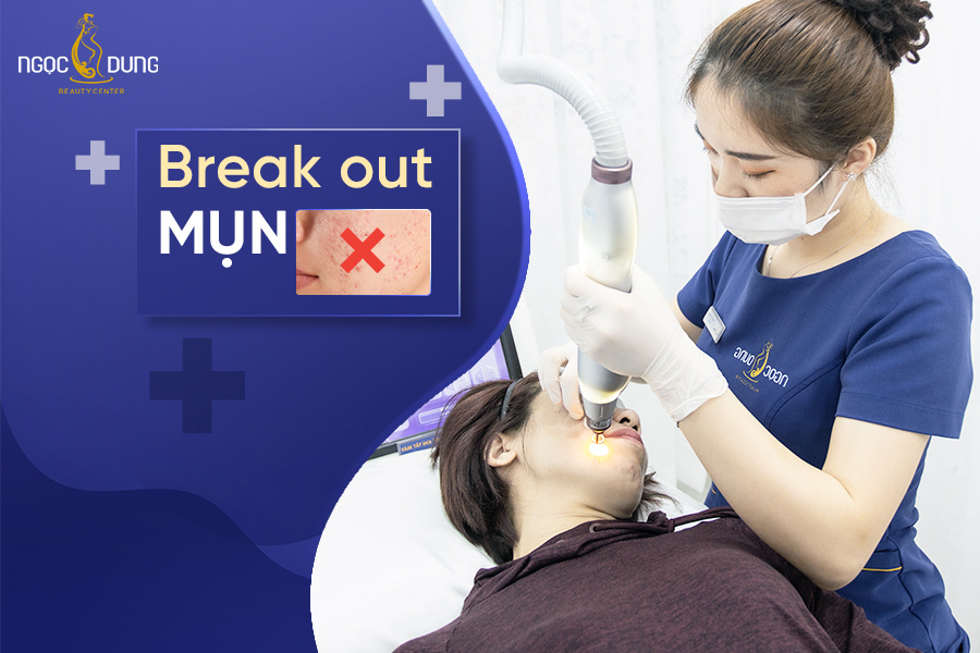 Break out mụn là gì? Nguyên nhân và cách cải thiện hiệu quả