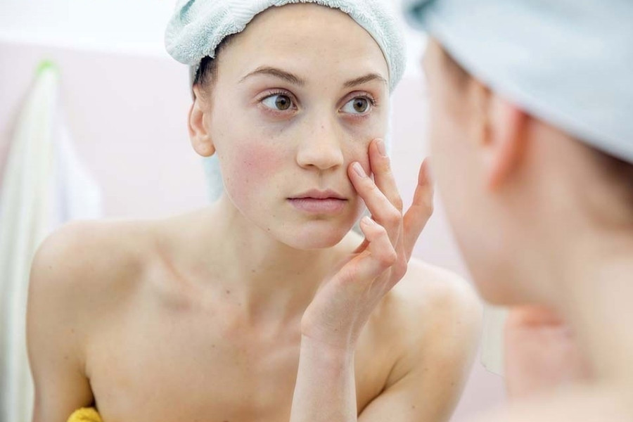 sử dụng nha đam sai cách có thể gây dị ứng da