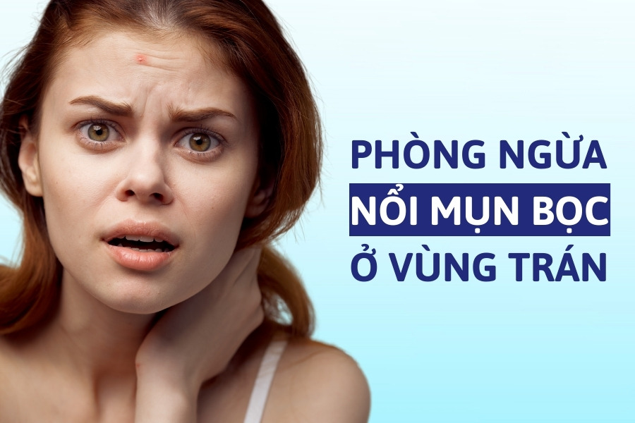Một số lưu ý chăm sóc da để ngăn ngừa mụn bọc ở trán tái phát Một số lưu ý chăm sóc da để ngăn ngừa mụn bọc ở trán tái phát