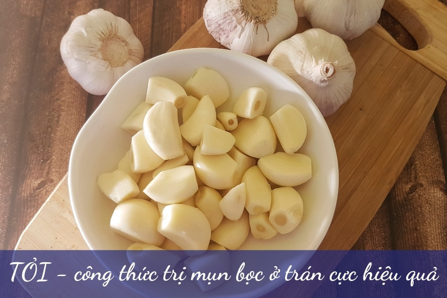 Tỏi giúp giảm viêm nhiễm, tiêu diệt vi khuẩn gây mụn bọc Tỏi giúp giảm viêm nhiễm, tiêu diệt vi khuẩn gây mụn bọc