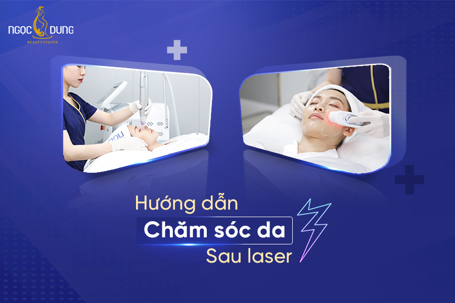 chăm sóc da sau laser