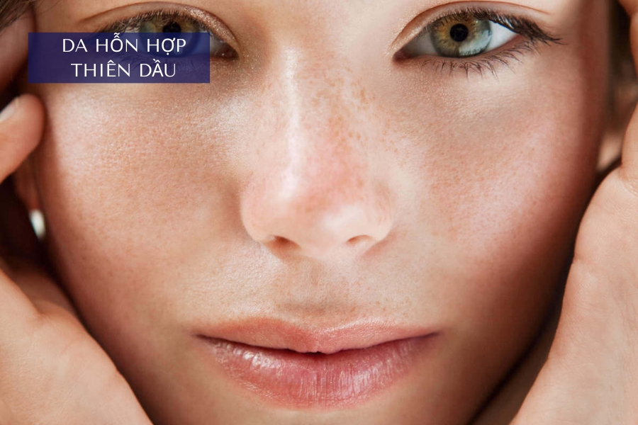 Da hỗn hợp thiên dầu nên dùng AHA hay BHA để trị mụn đầu đen