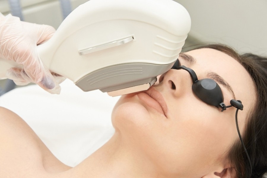 Công nghệ triệt lông thế hệ mới giúp loại bỏ hoàn toàn nang lông