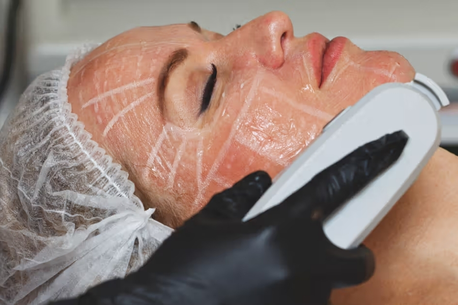 Đối tượng nào sẽ phù hợp với công nghệ nâng cơ - trẻ hóa da HIFU?