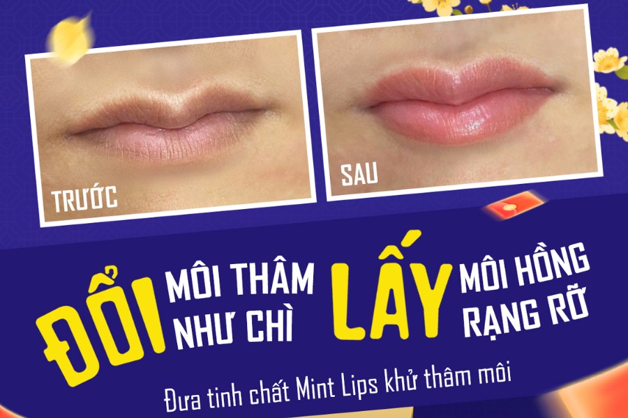 Công nghệ Đưa tinh chất Mint Lips của TMV Ngọc Dung hút sạch sắc tố thâm tận gốc, trả lại sắc môi hồng tự nhiên