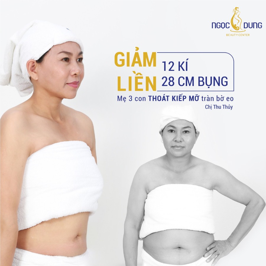 Công nghệ giảm mỡ Ultra Pro giúp khách hàng giảm liền 12kg và 28cm mỡ bụng