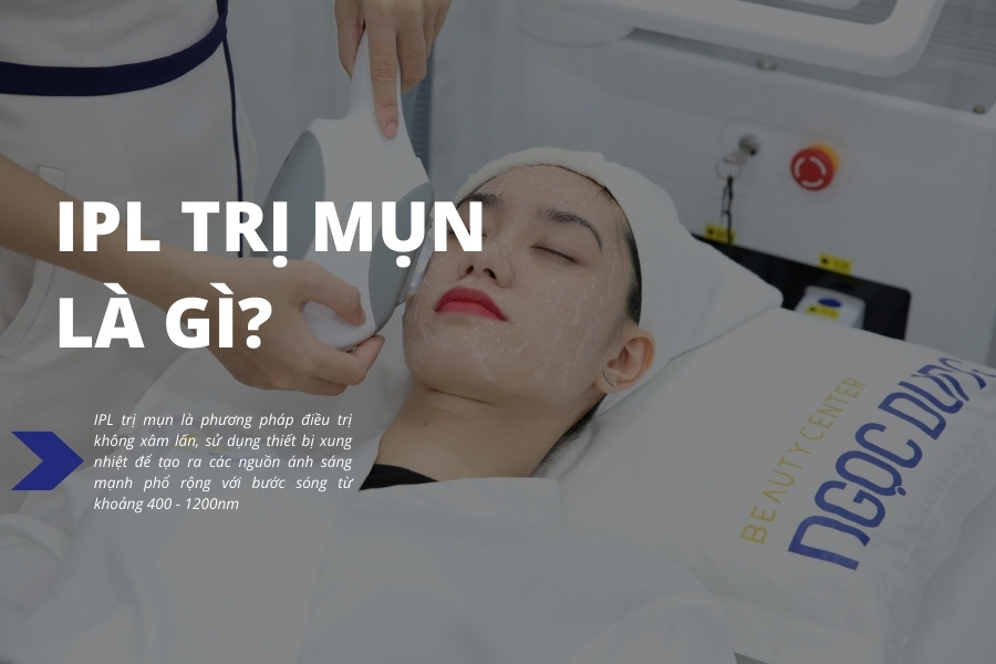 IPL là công nghệ điều trị mụn an toàn, hiệu quả nhất hiện nay