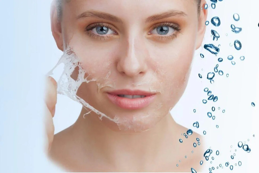 Da cổ bị sần do đâu? 6 Cách trẻ hoá da cổ hiệu quả, an toàn hiện nay 7 Peel da hoá học vùng cổ