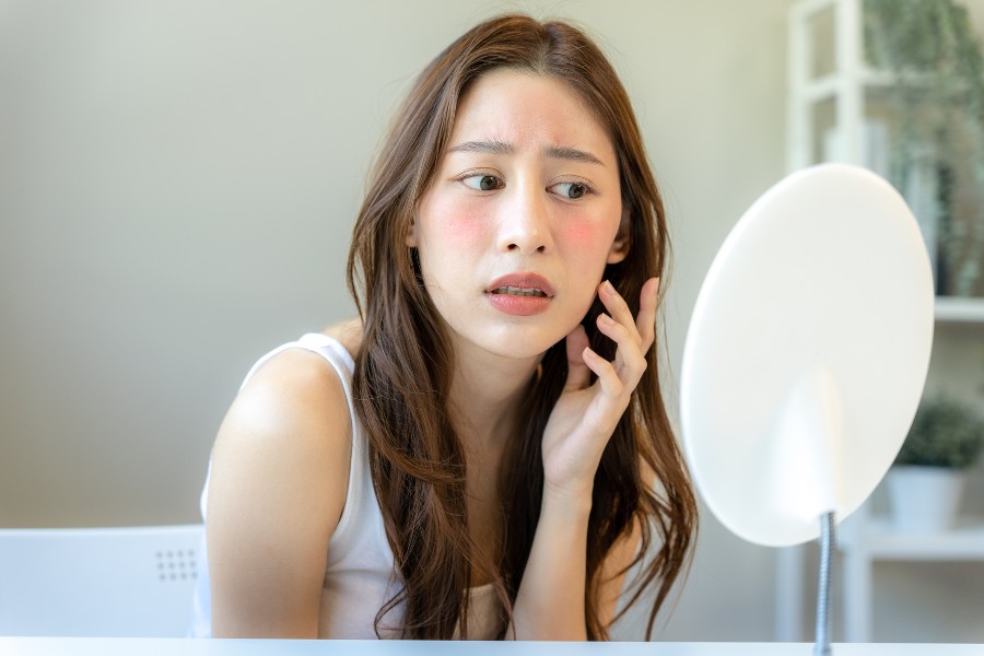 Dị ứng thuốc có thể nhận biết qua dấu hiệu như sần sùi, ngứa hoặc sưng tấy Da mặt bị dị ứng do thuốc