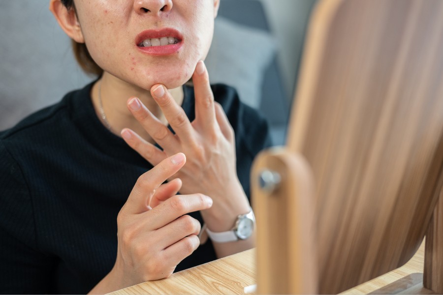 Tình trạng da mặt bị ngứa có thể để lại sẹo thâm, ảnh hưởng đến chất lượng cuộc sống Bị ngứa da mặt có nguy hiểm không