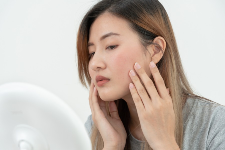 Một số trường hợp sốc phản vệ có thể dẫn đến những biến chứng nghiêm trọng như rát, sưng đỏ da Dị ứng ở mặt do sốc phản vệ