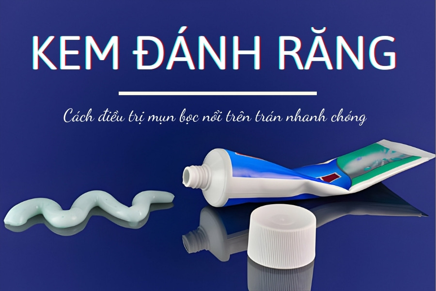 Lưu ý khi sử dụng kem đánh răng để giảm mụn bọc vì nó rất dễ gây kích ứng da Lưu ý khi sử dụng kem đánh răng để giảm mụn bọc vì nó rất dễ gây kích ứng da