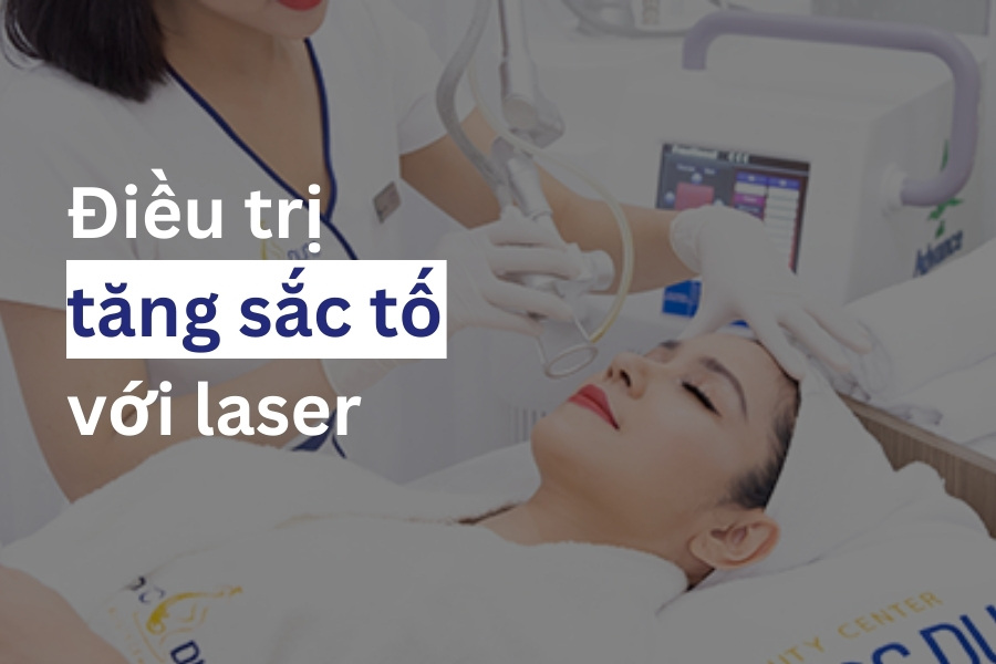 Điều trị tận gốc tình trạng tăng sắc tố Melanin bằng laser