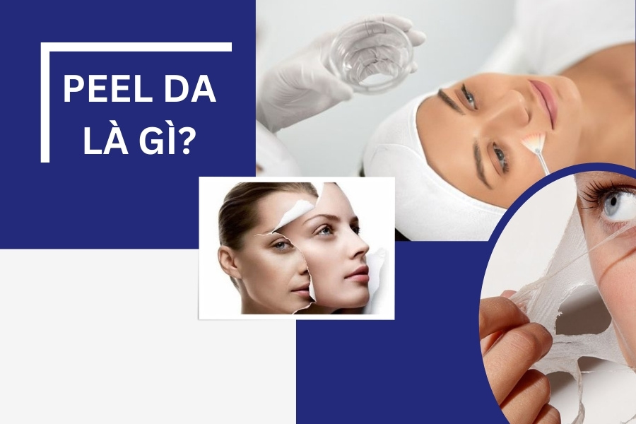 Peel da là phương pháp chăm sóc da bằng các hoạt chất hóa học
