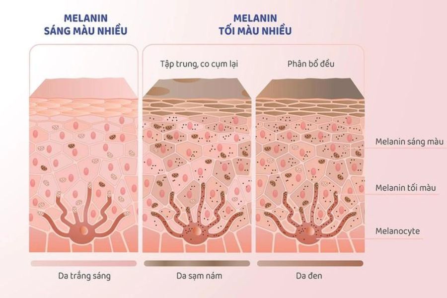 Melanin là gì? Melanin là một loại sắc tố tự nhiên có trong cơ thể, tạo màu cho da, tóc và mắt