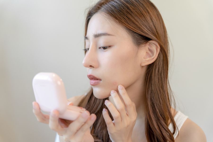 Thời gian phục hồi da tùy thuộc vào tình trạng da của mỗi người