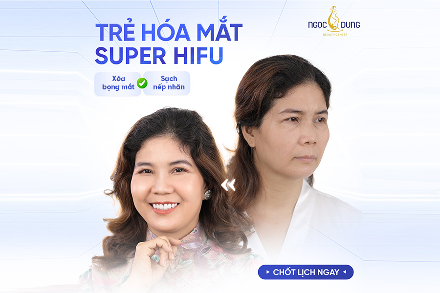Hình ảnh khác hàng sau khi chữa bọng mắt dưới với công nghệ Super Hifu