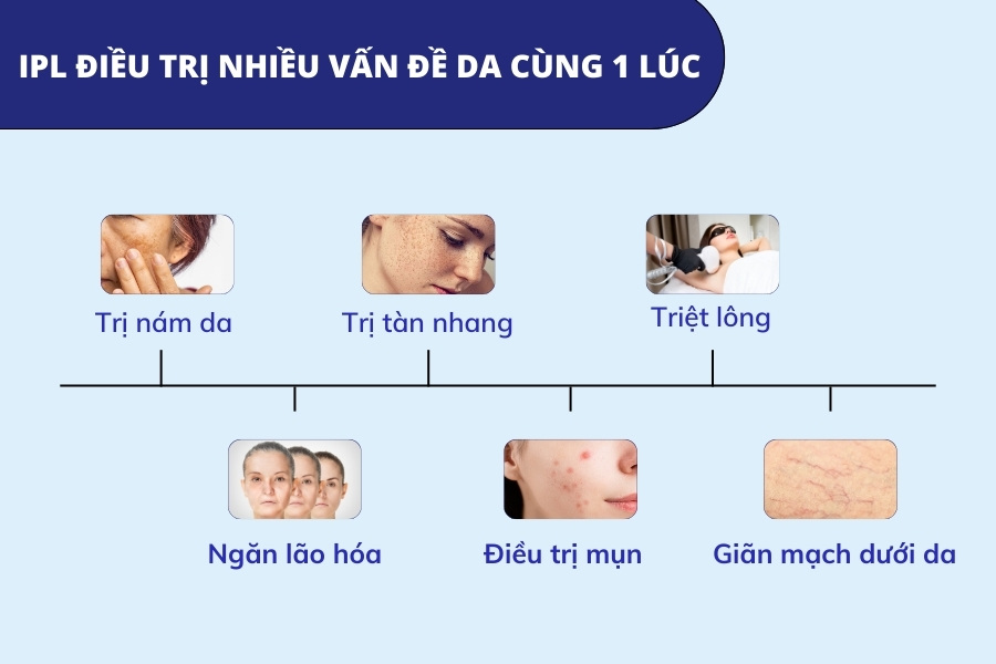 Công nghệ IPL được ứng dụng điều trị cho nhiều vấn đề về da cùng 1 lúc