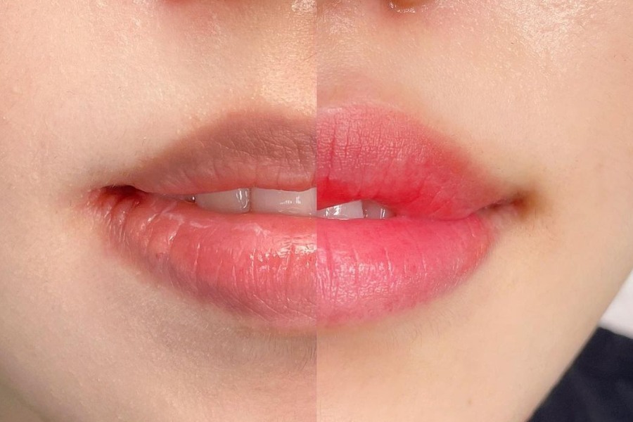  Khử sạch nền thâm, cấp ẩm cho đôi môi hồng hào, căng bóng