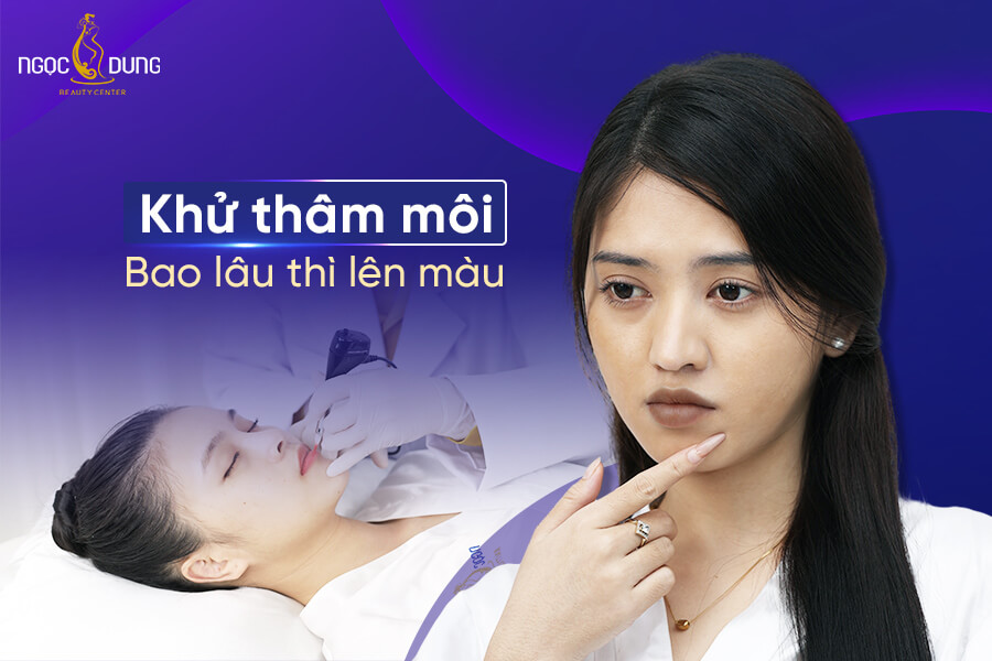 Khử thâm môi bao lâu thì lên màu? Ăn gì để môi lên màu nhanh?