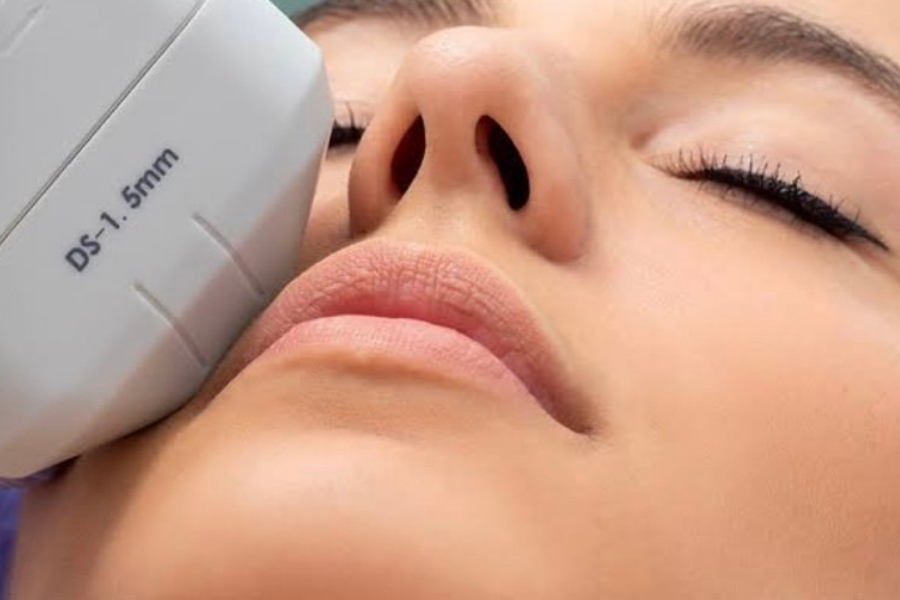 Những lưu ý sau khi làm HIFU nâng cơ da mặt 