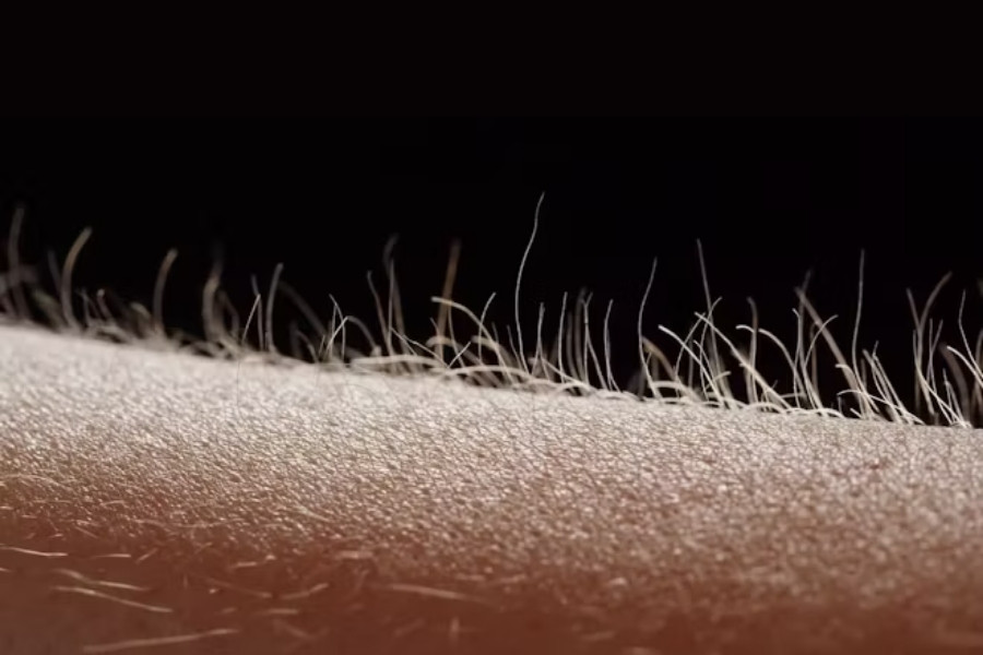 Tình trạng lông ngả vàng hoặc trắng có thể là nguyên nhân tiềm ẩn của một số vấn đề da liễu Lông tay có màu ngả vàng hoặc trắng