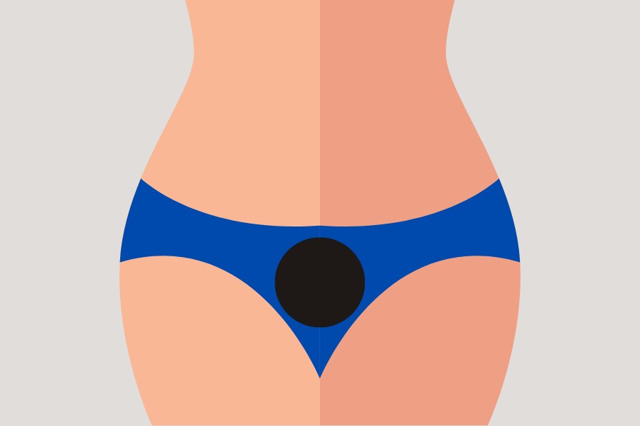 Mẫu tạo hình lông vùng kín nữ giới hình trăng tròn