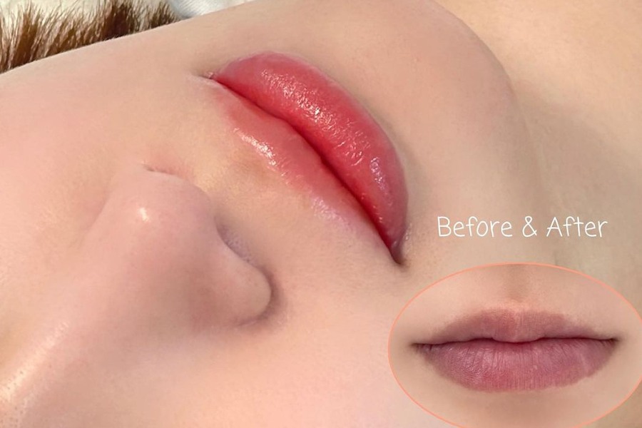 Vaseline có trị thâm môi không? Cách dưỡng môi bằng vaseline 11 môi căng mướt, hồng hào, mềm mịn, siêu thích