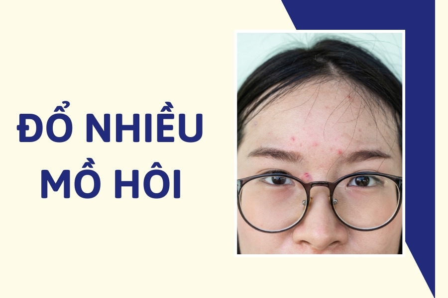 Mồ hôi rất tốt cho làn da nhưng nếu không được làm sạch đúng cách sẽ gây ra mụn bọc Mồ hôi rất tốt cho làn da nhưng nếu không được làm sạch đúng cách sẽ gây ra mụn bọc