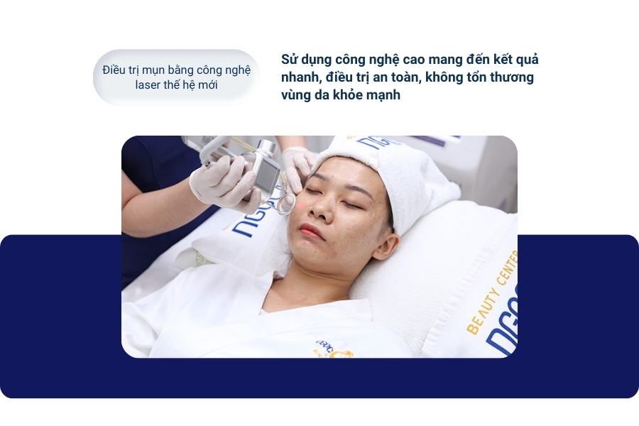 Điều trị mụn nội tiết dứt điểm bằng công nghệ cao tại TMV Ngọc Dung Điều trị mụn nội tiết dứt điểm bằng công nghệ cao tại TMV Ngọc Dung
