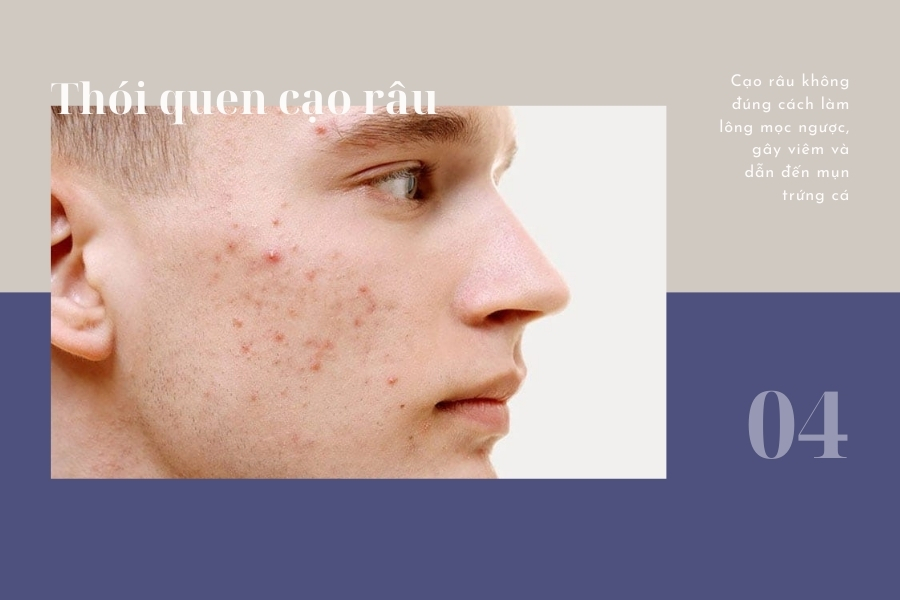 Cạo râu không đúng cách làm tổn thương mô da, gây viêm và nổi mụn Cạo râu không đúng cách làm tổn thương mô da, gây viêm và nổi mụn