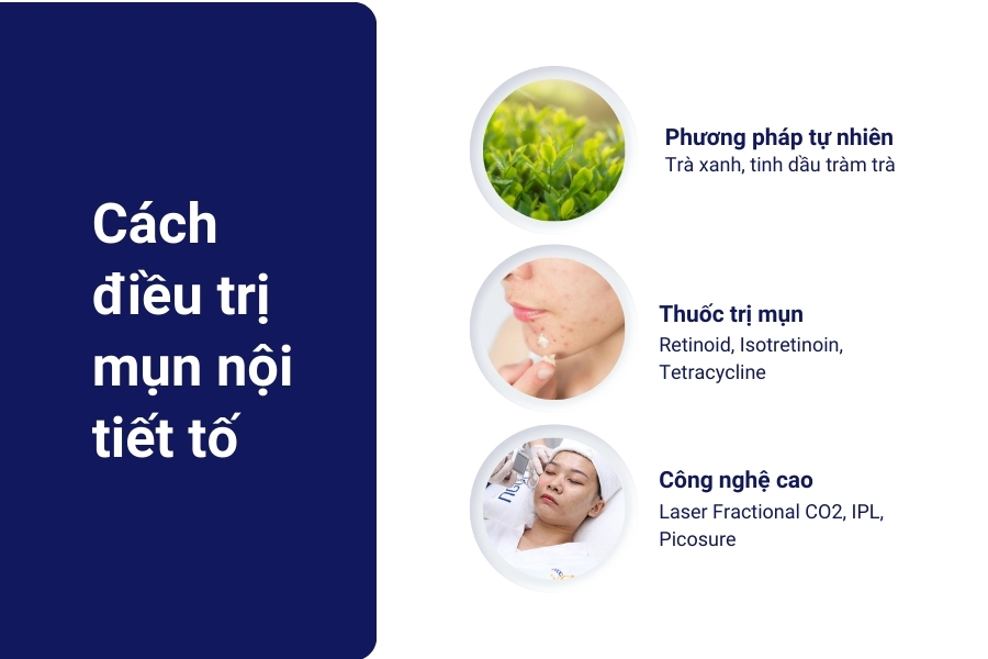 Nên trị mụn nội tiết như thế nào? Nên trị mụn nội tiết như thế nào?