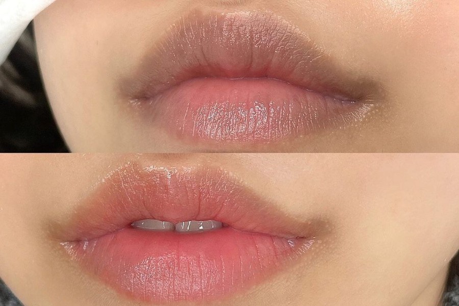 Nền môi thâm viền nặng, da dầu do cơ địa cũng là nguyên nhân khiến môi phun xong dễ bị nhạt lòng môi
