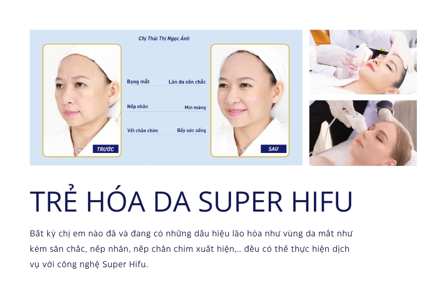 Làm HIFU ở đâu tốt nhất?