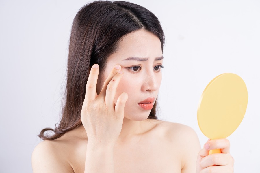 Sau khi tái tạo da có thể bị sưng nhẹ